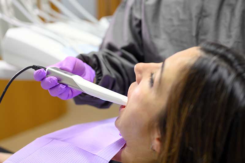 Intraoral Cameras in San Jose